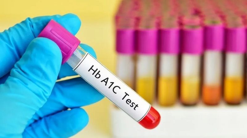 Chỉ Số HbA1c Là Gì Về Mặt Y Khoa?